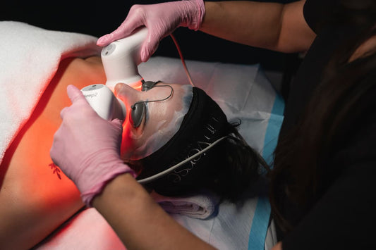 The Benefits of RF Microneedling with Matrix Pro at SkinVerse