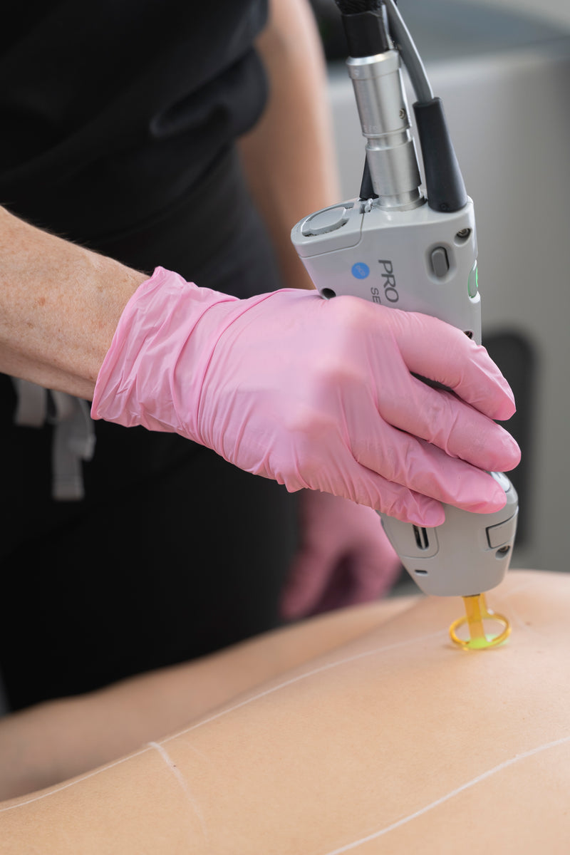 LASER HAIR REMOVAL